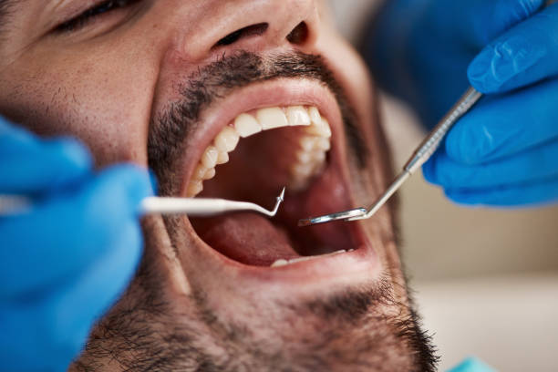 Best Chipped Tooth Repair Near Me  in Coal City, IL